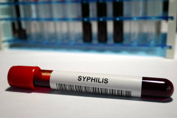 Fox big box | Стадии и симптомы сифилиса